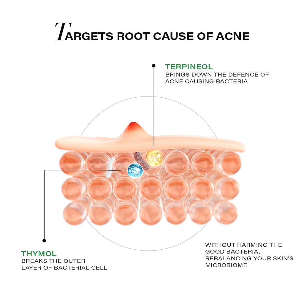 Acne Clearing & Hydrating Regime