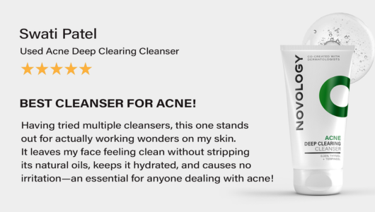 acne cleanser review